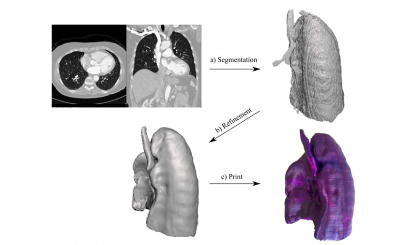 Application of 3D-Modeling in Medicine  in Preparation for 3D-Printing